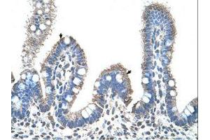 Image no. 1 for anti-Solute Carrier Family 22 (Organic Cation Transporter), Member 1 (SLC22A1) (C-Term) antibody (ABIN203397)