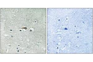 Immunohistochemistry analysis of paraffin-embedded human brain tissue, using TTK (Ab-676) Antibody.