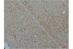 Immunohistochemistry (IHC) analysis of paraffin-embedded Rat Brain Tissue using Cav pan alpha1Rabbit Polyclonal Antibody diluted at 1:200. (Cav Pan Alpha1 (pan) anticorps)