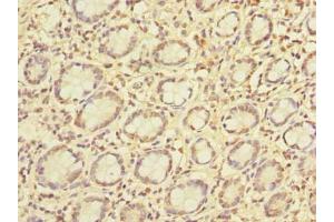 Immunohistochemistry of paraffin-embedded human small intestine tissue using ABIN7163413 at dilution of 1:100