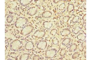 Immunohistochemistry of paraffin-embedded human small intestine tissue using ABIN7163413 at dilution of 1:100 (PCIF1 anticorps  (AA 201-500))