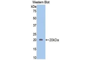 Western blot analysis of the recombinant protein. (Androgen Receptor anticorps  (AA 765-902))