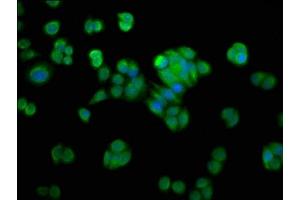Immunofluorescence staining of PC-3 cells with ABIN7161661 at 1:200, counter-stained with DAPI. (NMRAL1 anticorps  (AA 1-299))