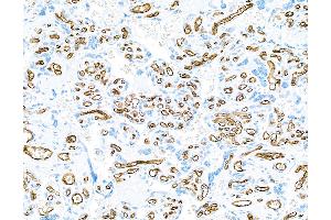 Immunohistochemistry (IHC) image for anti-CD34 (CD34) (AA 33-290) antibody (ABIN7453960) (Recombinant CD34 anticorps  (AA 33-290))