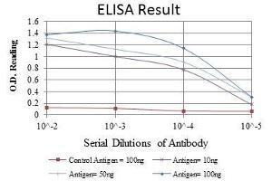 Red: Control Antigen (100 ng), Purple: Antigen (10 ng), Green: Antigen (50 ng), Blue: Antigen (100 ng), (OTX2 anticorps)