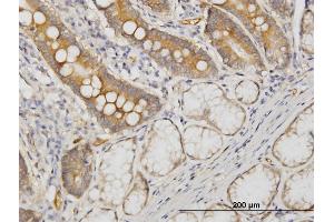 Immunoperoxidase of monoclonal antibody to CDC42BPB on formalin-fixed paraffin-embedded human small Intestine. (CDC42BPB anticorps  (AA 1580-1679))