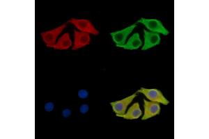 ABIN7096606 and ABIN7100670 staining Hela cells by IF/ICC.