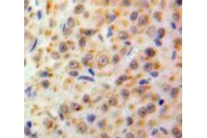 IHC-P analysis of Ovary tissue, with DAB staining. (NUP50 anticorps  (AA 134-393))