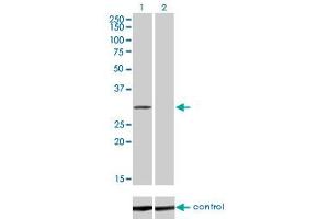Western blot analysis of COASY over-expressed 293 cell line, cotransfected with COASY Validated Chimera RNAi (Lane 2) or non-transfected control (Lane 1).