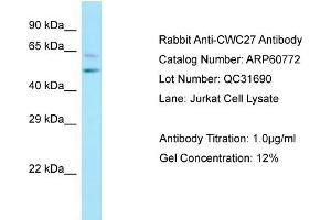 Western Blotting (WB) image for anti-CWC27 Spliceosome-Associated Protein Homolog (Cwc27) (C-Term) antibody (ABIN2788570) (Cwc27 anticorps  (C-Term))