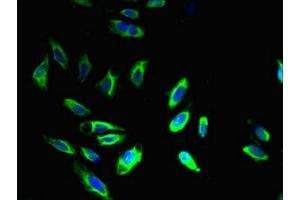 Immunofluorescence staining of Hela cells with ABIN7145178 at 1:400, counter-stained with DAPI. (BCAP31 anticorps  (AA 2-243))
