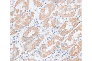 Immunohistochemistry of paraffin-embedded Human stomach using PAEP Polyclonal Antibody at dilution of 1:100 (40x lens). (PAEP anticorps)