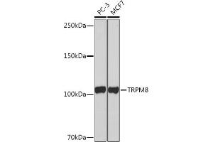 Western blot analysis of extracts of various cell lines, using TRPM8 Rabbit mAb (ABIN1678662, ABIN3018757, ABIN3018758 and ABIN7101657) at 1:1000 dilution.
