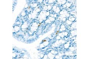 Immunohistochemistry of paraffin embedded mouse colon using IL34 (ABIN7074359) at dilution of 1:900 (400x lens) (IL-34 anticorps)