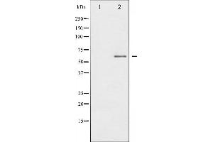 Western blot analysis of IL-10R alpha phosphorylation expression in HuvEc whole cell lysates,The lane on the left is treated with the antigen-specific peptide. (IL-10RA anticorps  (pTyr496))