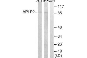 Western Blotting (WB) image for anti-Amyloid beta (A4) Precursor-Like Protein 2 (APLP2) (Internal Region) antibody (ABIN1850752) (APLP2 anticorps  (Internal Region))