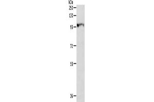 Gel: 8 % SDS-PAGE, Lysate: 40 μg, Lane: Human fetal liver tissue, Primary antibody: ABIN7130225(MGEA5 Antibody) at dilution 1/300, Secondary antibody: Goat anti rabbit IgG at 1/8000 dilution, Exposure time: 30 seconds (MGEA5 anticorps)