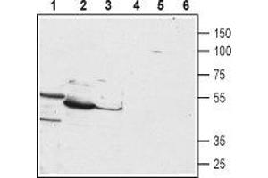 Western blot analysis of HepG2 (lanes 1 and 4), mouse liver (lanes 2 and 5) and rat liver (lanes 3 and 6) lysates: - 1-3. (PTH1R anticorps  (1st Extracellular Loop))