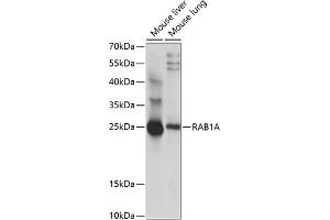 Western blot analysis of extracts of various cell lines, using RA antibody (ABIN7269797) at 1:1000 dilution. (RAB1A anticorps  (AA 1-100))