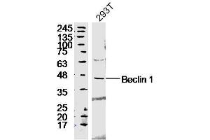 293T lyates probed with Rabbit Anti-Beclin 1 Polyclonal Antibody, Unconjugated  at 1:300 in 4˚C overnight.