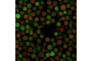 Immunofluorescent staining of Jurkat cells.