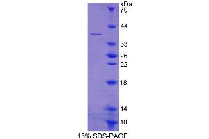 SDS-PAGE analysis of Human GYPE Protein. (GYPE Protéine)