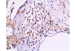 Formalin-fixed and paraffin embedded rat cochlea tissue labeled Anti-NF-M/Neurofilament M Polyclonal Antibody, Unconjugated  at 1:200, followed by conjugation to the secondary antibody and DAB staining