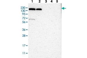 Western blot analysis of Lane 1: RT-4, Lane 2: U-251 MG, Lane 3: Human Plasma, Lane 4: Liver, Lane 5: Tonsil with KIAA0355 polyclonal antibody  at 1:250-1:500 dilution. (KIAA0355 anticorps)