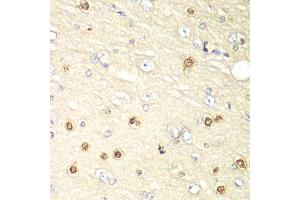 Immunohistochemistry of paraffin-embedded rat brain using HIF1AN antibody (ABIN5973179) at dilution of 1/100 (40x lens). (HIF1AN anticorps)