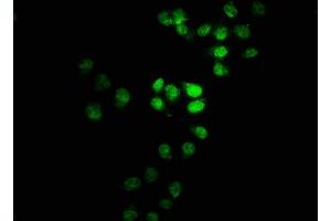 Immunofluorescence staining of Hela cells with ABIN7171492 at 1:100, counter-stained with DAPI. (TBKBP1 anticorps  (AA 327-427))