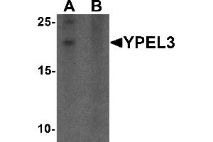 Western blot analysis of YPEL3 in A-20 cell lysate with YPEL3 antibody at 1 µg/mL in (A) the absence and (B) the presence of blocking peptide (YPEL3 anticorps  (N-Term))