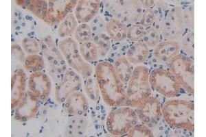 DAB staining on IHC-P; Samples: Rat Kidney Tissue (GIP anticorps  (AA 11-124))