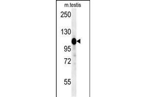 Western blot analysis in mouse testis tissue lysates (15ug/lane). (DACT1 anticorps  (N-Term))