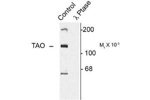 Image no. 1 for anti-TAO Kinase 2 (TAOK2) (pSer181) antibody (ABIN372726) (TAO Kinase 2 anticorps  (pSer181))
