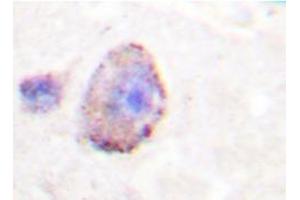 Immunohistochemistry analyzes of PLC β3 antibody in paraffin-embedded human brain tissue. (PLCB3 anticorps)
