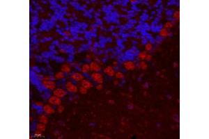 Immunofluorescence of paraffin embedded mouse cerebellum using ZNF295 (ABIN7076264) at dilution of 1: 650 (400x lens)