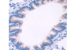 Figure. (CTLA4 anticorps  (AA 41-192))
