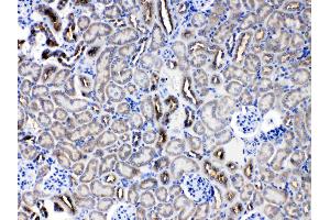SERPINA5 was detected in paraffin-embedded sections of mouse kidney tissues using rabbit anti- SERPINA5 Antigen Affinity purified polyclonal antibody (Catalog # ) at 1 µg/mL.