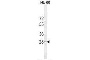 METTL10 Antibody (N-term) western blot analysis in HL-60 cell line lysates (35µg/lane). (METTL10 anticorps  (N-Term))