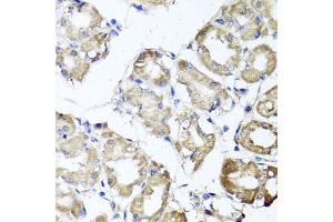 Immunohistochemistry of paraffin-embedded human stomach using MGAT1 antibody (ABIN5975025) at dilution of 1/100 (40x lens). (MGAT1 anticorps)