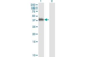 Western Blot analysis of ANXA2 expression in transfected 293T cell line by ANXA2 monoclonal antibody (M01), clone 3E8-B6.