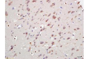 Formalin-fixed and paraffin embedded rat brain labeled with Rabbit Anti-ANKRD9 Polyclonal Antibody, Unconjugated (ABIN2170251) at 1:200 followed by conjugation to the secondary antibody and DAB staining (ANKRD9 anticorps  (AA 21-200))
