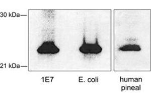 Western blot analysis of AANAT using AANAT polyclonal antibody . (AANAT anticorps)