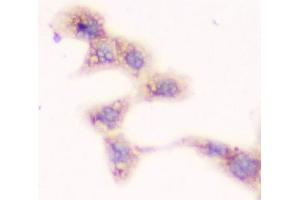 ICC testing of FFPE human A431 cells with SMN1/2 antibody. (SMN1 / SMN2 anticorps)