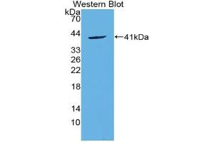Western blot analysis of the recombinant protein. (CCL20 anticorps  (AA 24-95))