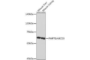 Western blot analysis of extracts of various cell lines, using PMP70/ Rabbit mAb (ABIN1683181, ABIN3018647, ABIN3018648 and ABIN7101638) at 1:1000 dilution. (CX3CL1 anticorps)