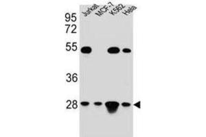 Western Blotting (WB) image for anti-Transcription Factor A, Mitochondrial (TFAM) antibody (ABIN5015230) (TFAM anticorps)