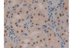 Detection of HDGF in Human Kidney Tissue using Polyclonal Antibody to Hepatoma Derived Growth Factor (HDGF) (HDGF anticorps  (AA 10-240))