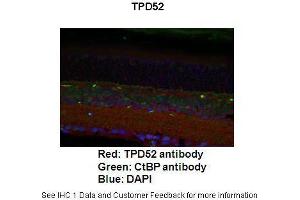 Application: ImmunofluorescenceSpecies+tissue/cell type: Mouse retina Primary Antibody dilution: 1:200Secondary Antibody: Goat anti-rabbit Alexafluor 568 Secondary Antibody Dilution: 1:000 (TPD52 anticorps  (C-Term))