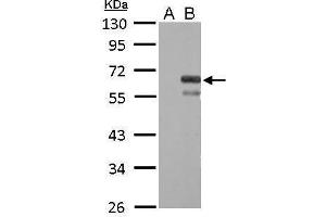 WB Image Factor X antibody detects F10 protein by Western blot analysis. (Coagulation Factor X anticorps)